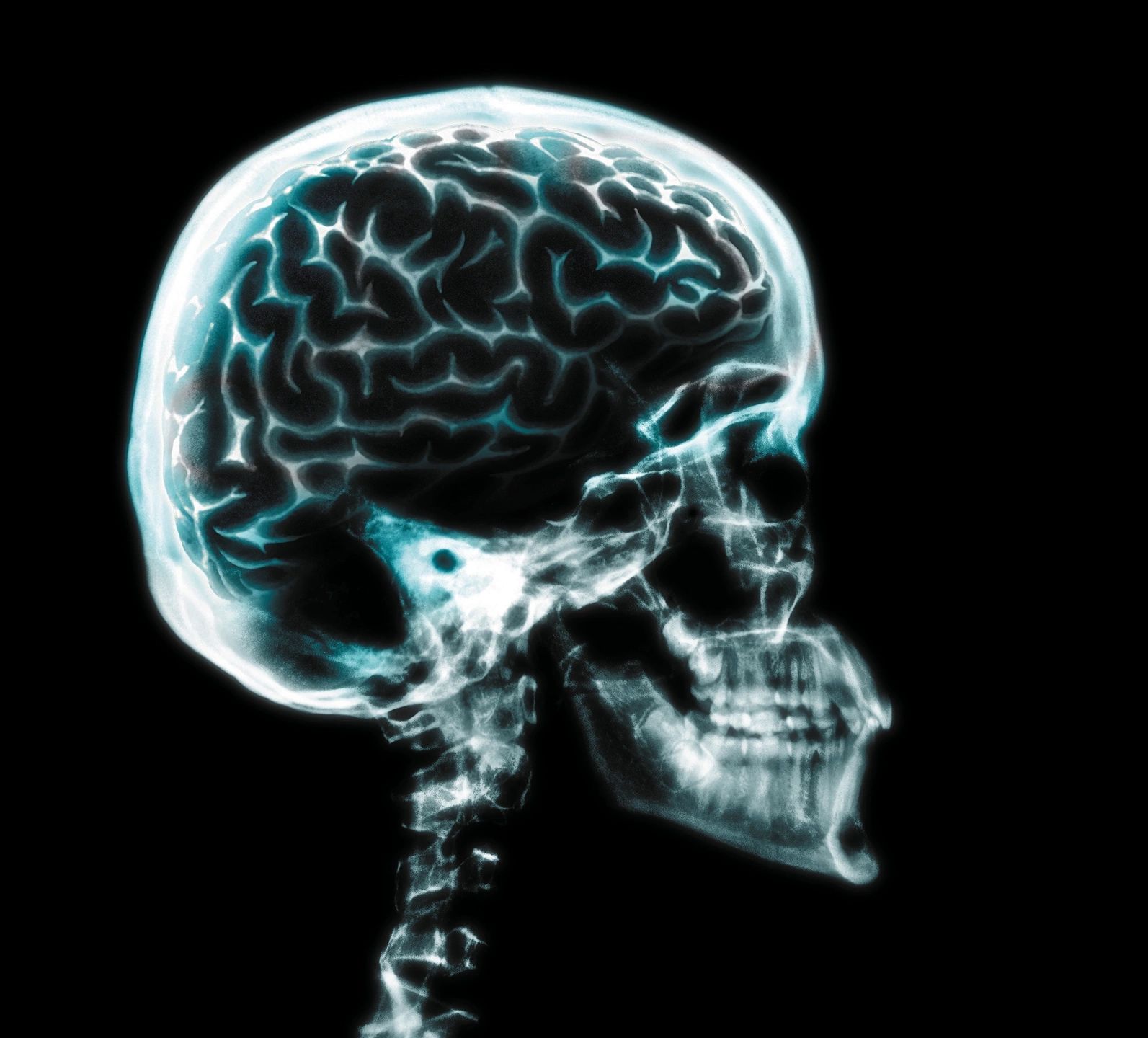 X-ray of the human skull